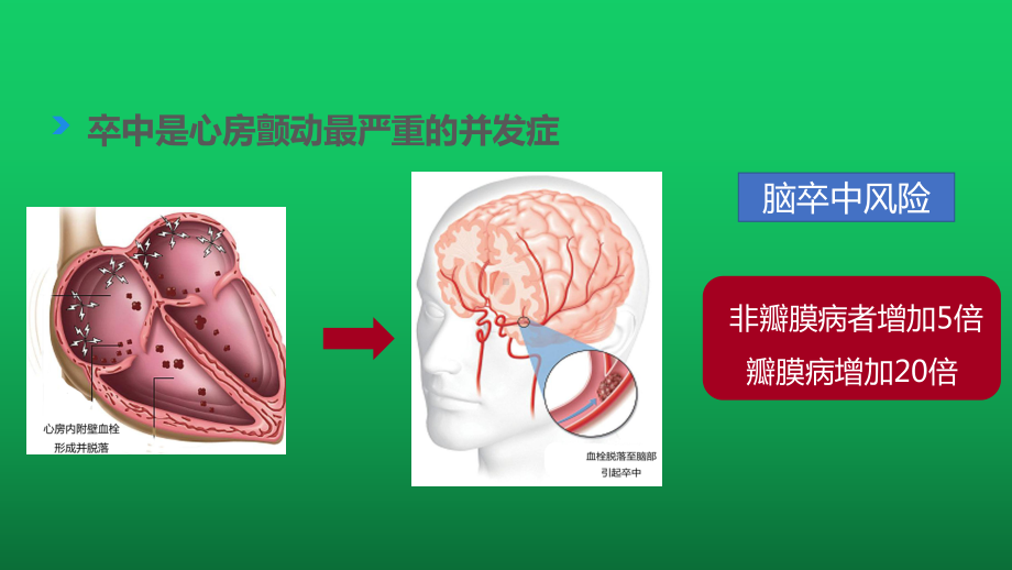 心房颤动的抗凝治疗策略与出血的防治课件.pptx_第3页