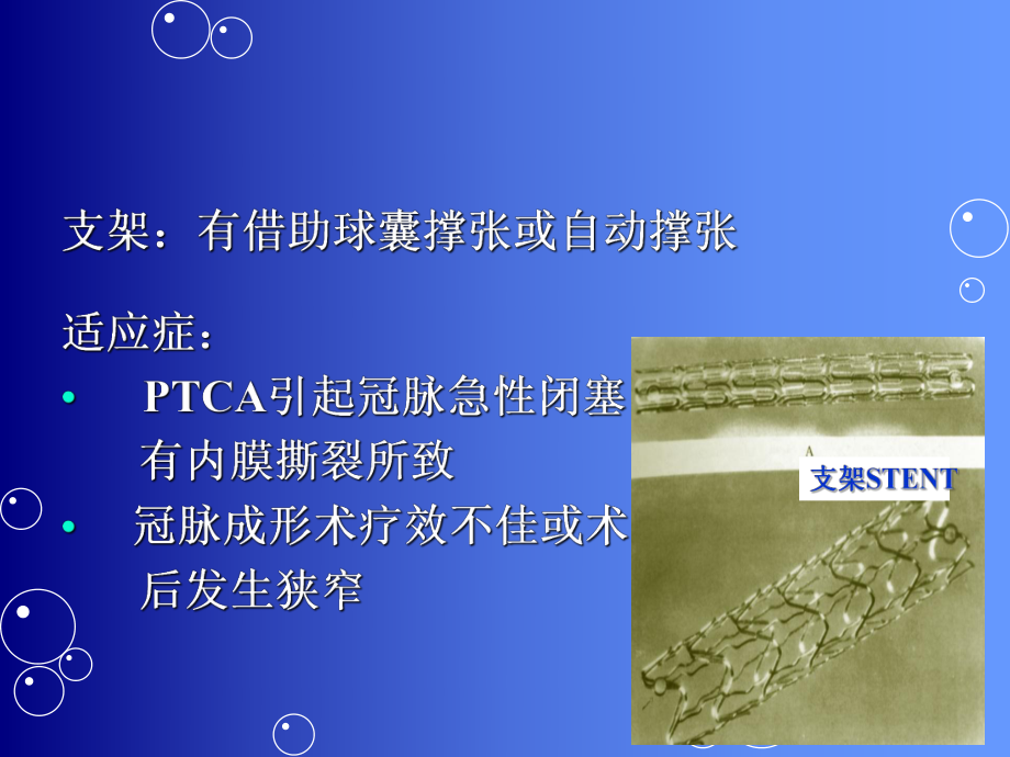 心血管病介入护理PPT课件.ppt_第2页