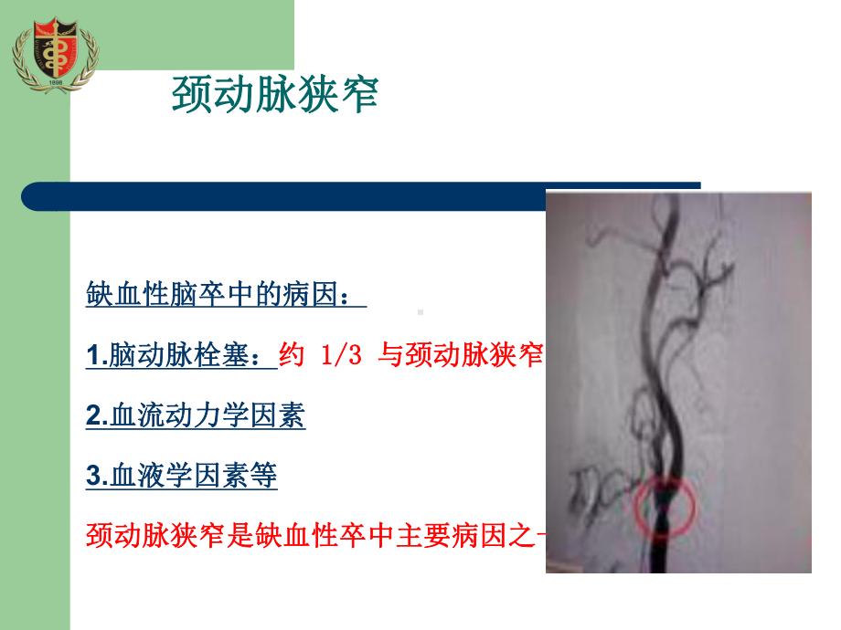 颈动脉支架植入护理查房41426课件.ppt_第3页