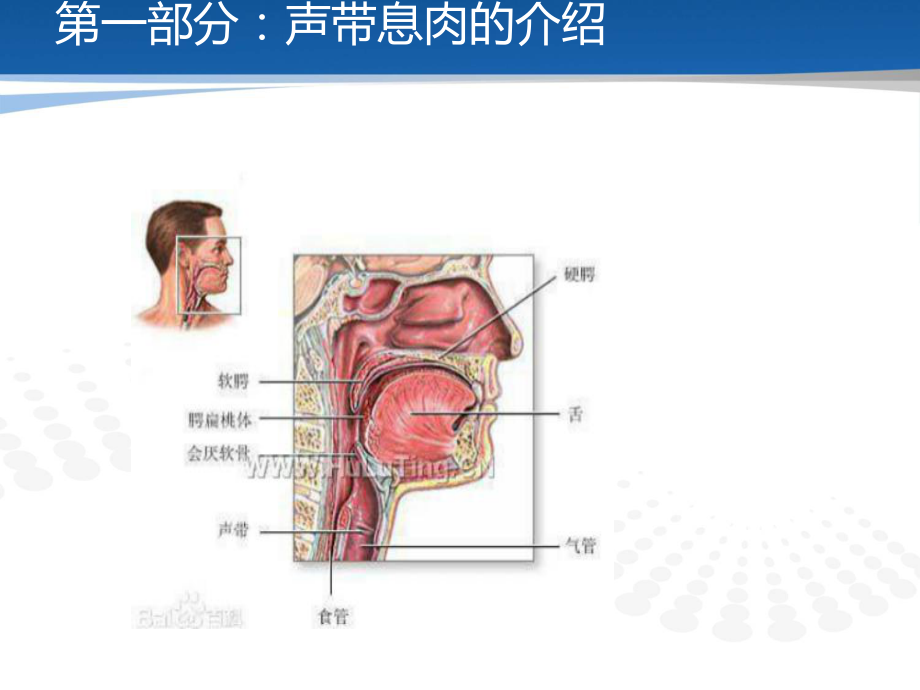 声带息肉患者护理查房课件.pptx_第3页