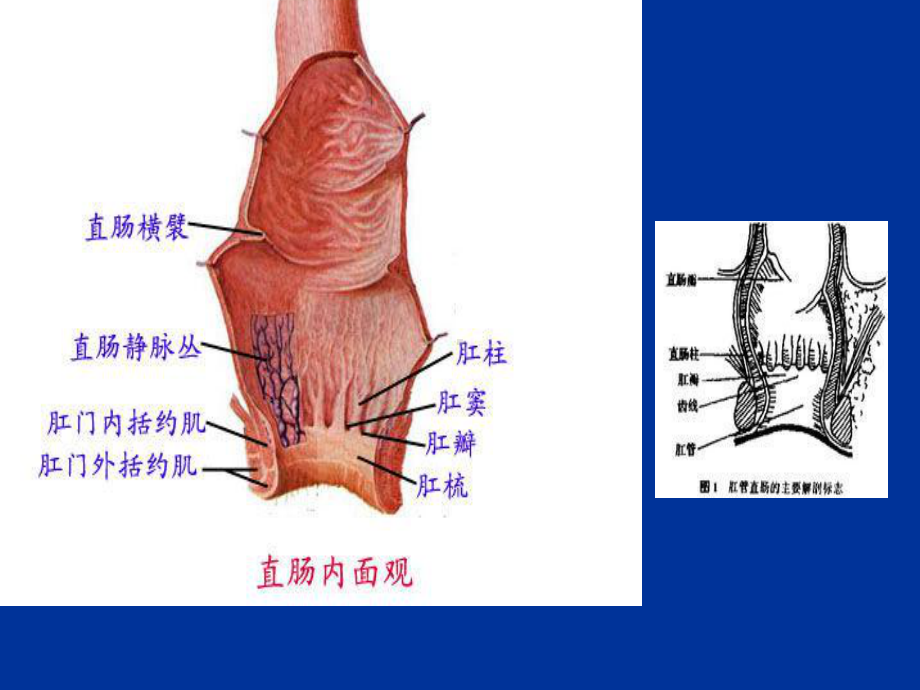 痔疮病人的护理完整版课件.ppt_第3页