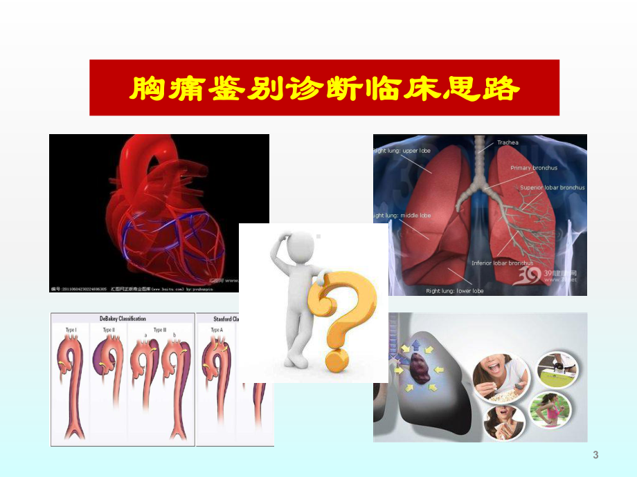 胸痛诊断与鉴别诊断ppt课件.ppt_第3页