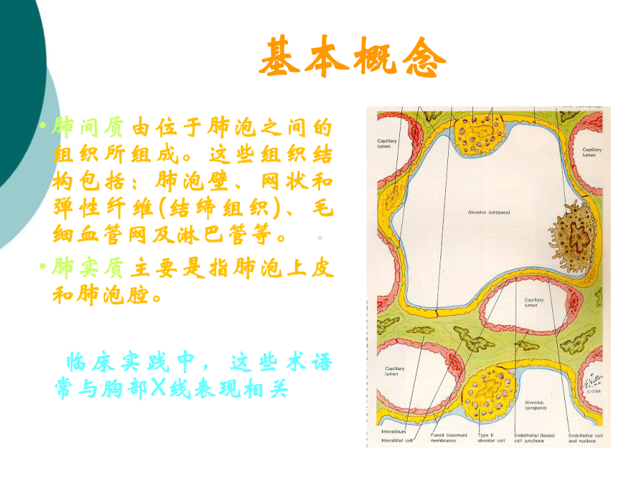 间质性肺病的诊断思路课件.ppt_第3页