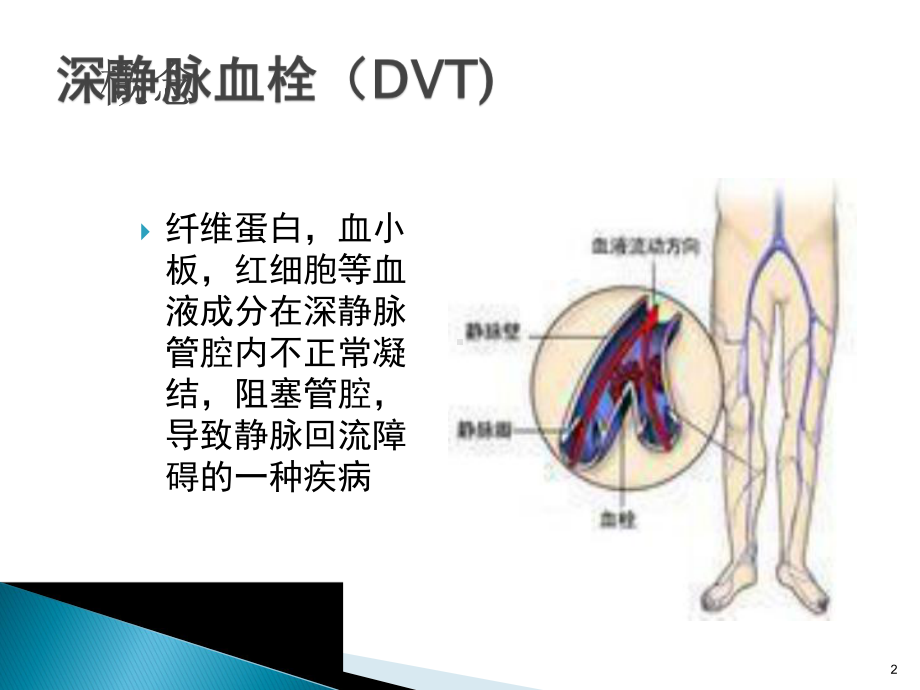 静脉血栓及预防PPT课件.ppt_第2页