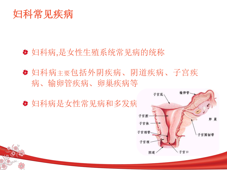 妇科常见疾病的预防和治疗课件.pptx_第2页