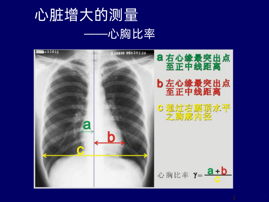 心血管疾病影像学诊断PPT课件.ppt_第2页