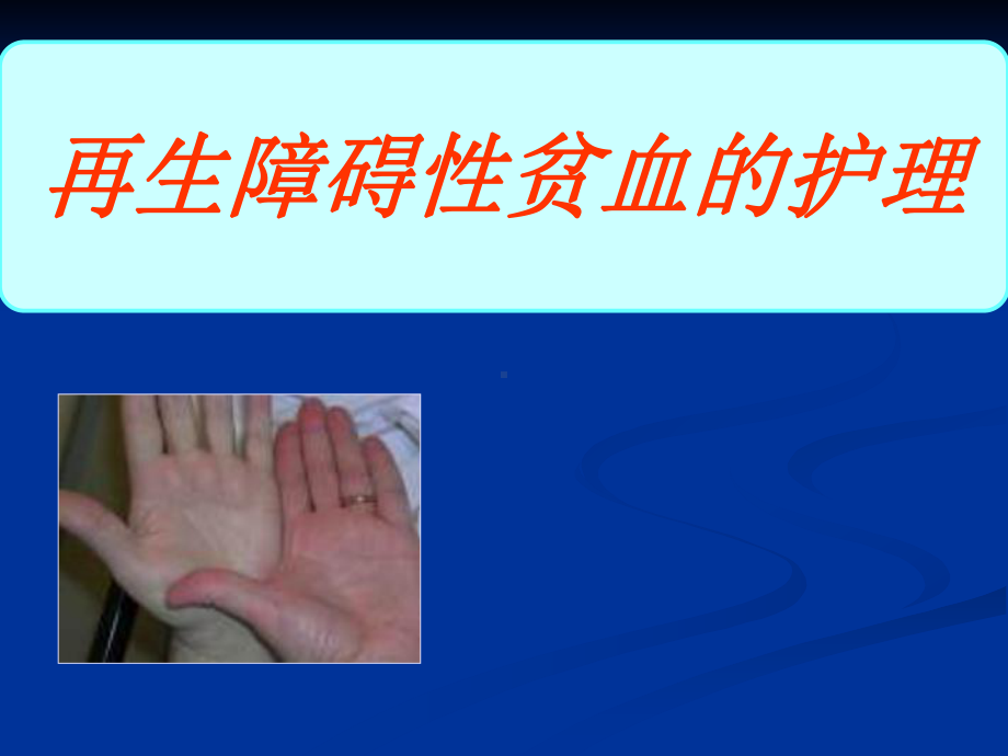 再生障碍性贫血的护理课件.ppt_第1页