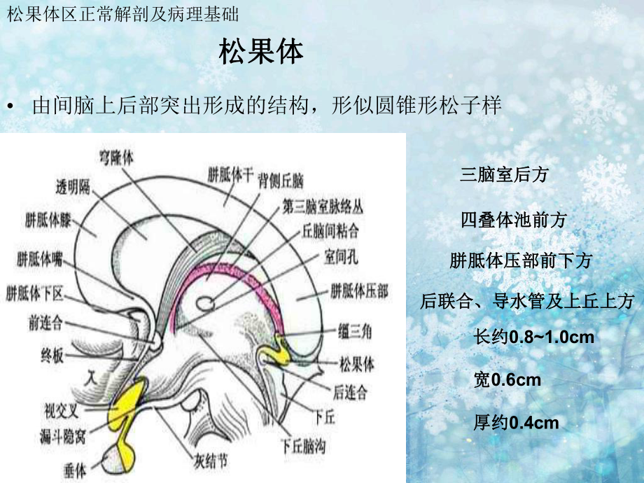 松果体区占位的影像诊断课件.ppt_第3页