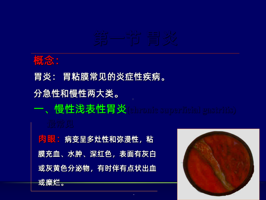 消化系统疾病ppt课件1.ppt_第3页