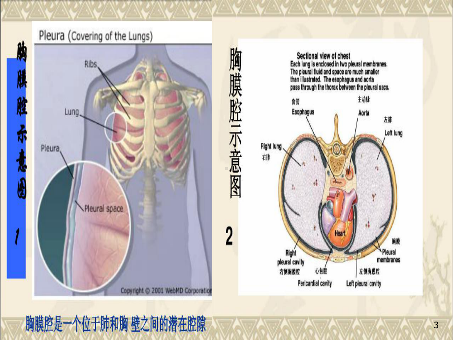 胸腔闭式引流的护理PPT课件1.ppt_第3页