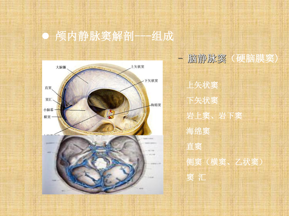 颅内静脉窦血栓形成的影像学表现PPT课件.ppt_第3页