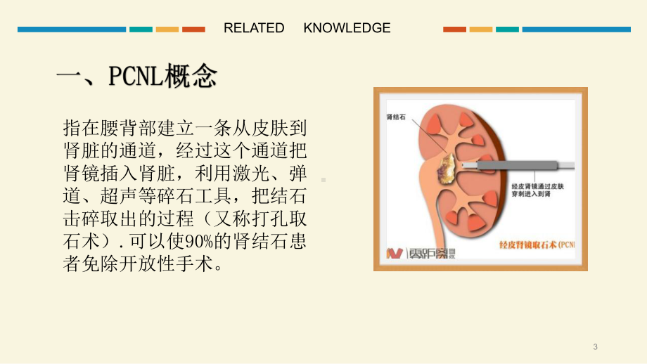 经皮肾镜碎石取石术护理配合PPT课件.ppt_第3页