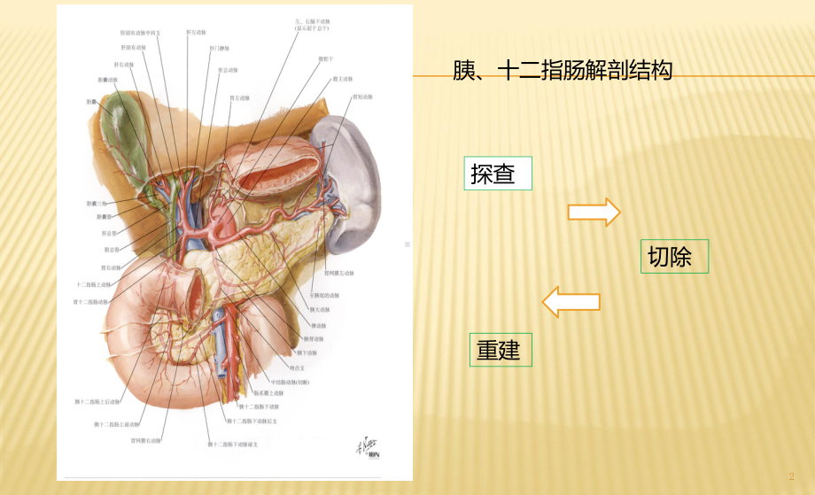 胰十二指肠切除术术式图解ppt课件.pptx_第2页