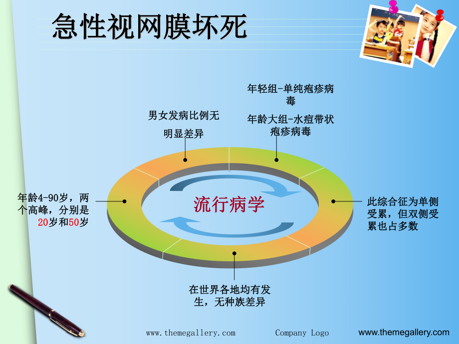 急性视网膜坏死综合症演示课件.ppt_第3页