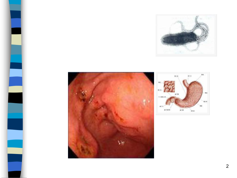 慢性胃炎-PPT课件.ppt_第2页