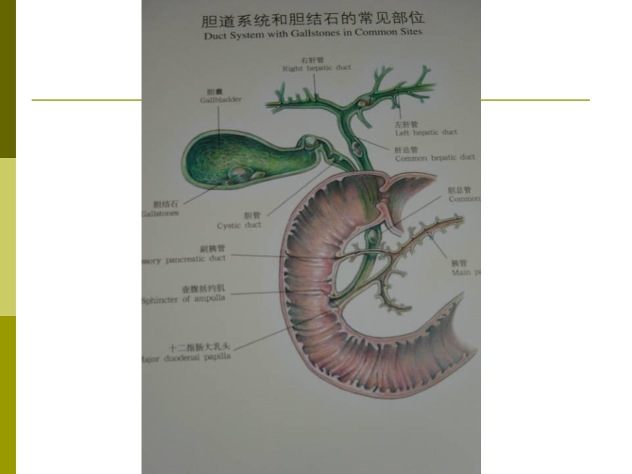 胆囊结石成因和治疗进展课件.ppt_第2页