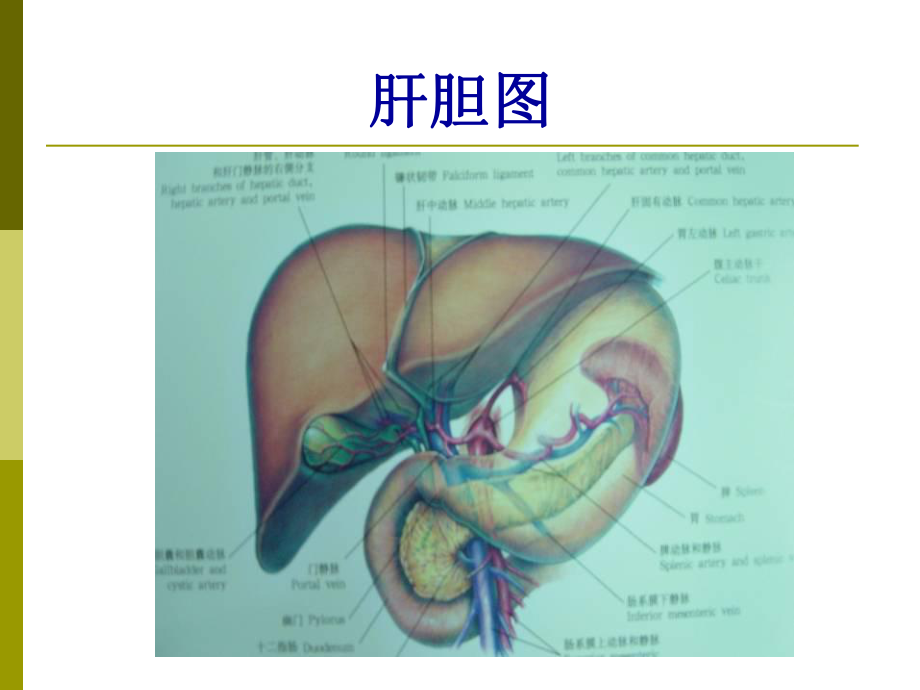 胆囊结石成因和治疗进展课件.ppt_第3页