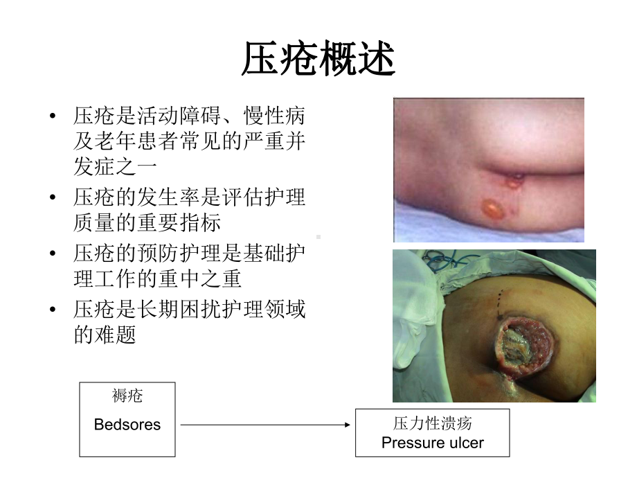 压疮护理最新进展及指南课件.ppt_第3页