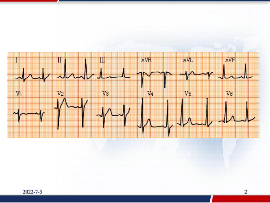 诊断学-器械检查-心电图-PPT课件.pptx_第2页