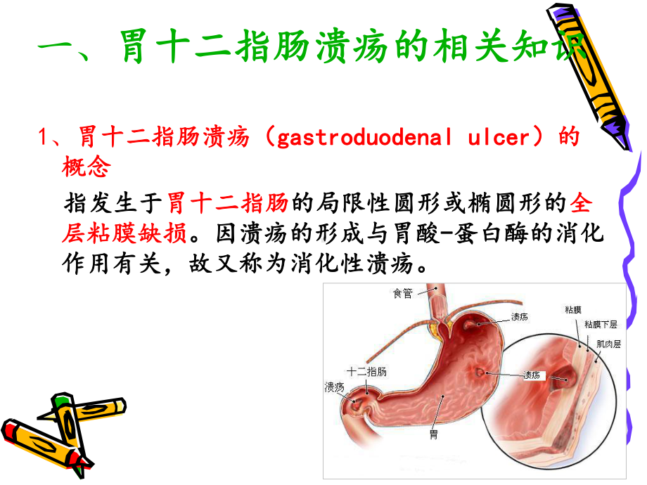 胃十二指肠溃疡病人的-护理课件.ppt_第3页