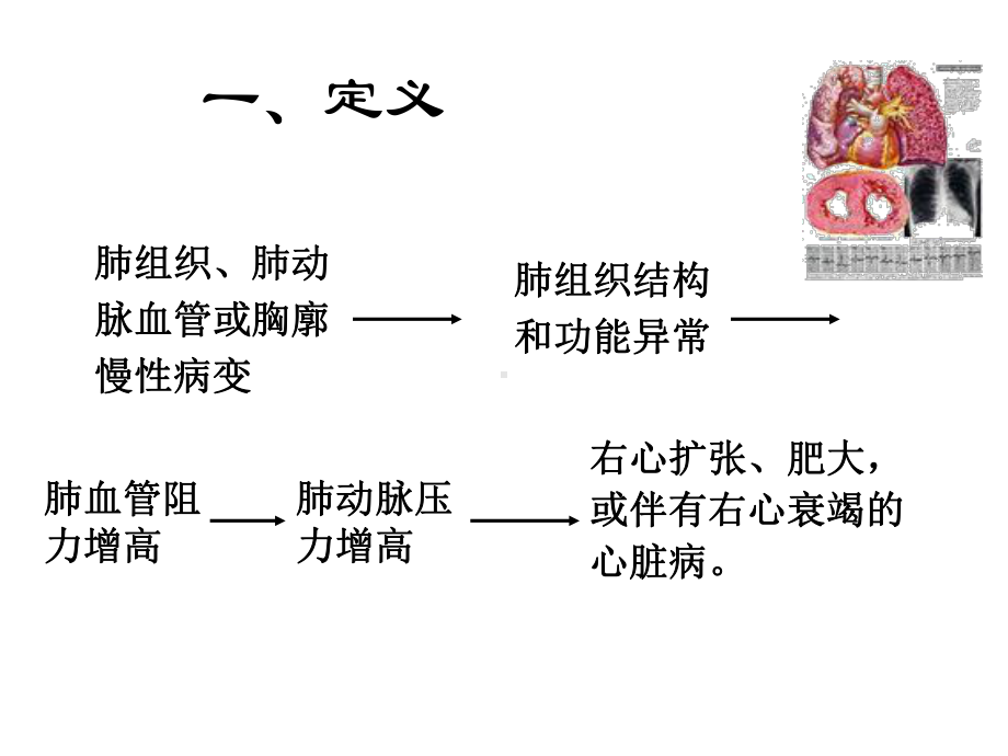 慢性肺源性心脏病的护理课件.ppt_第3页