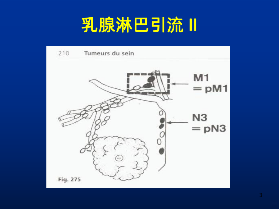 乳腺癌放射治疗PPT课件.ppt_第3页