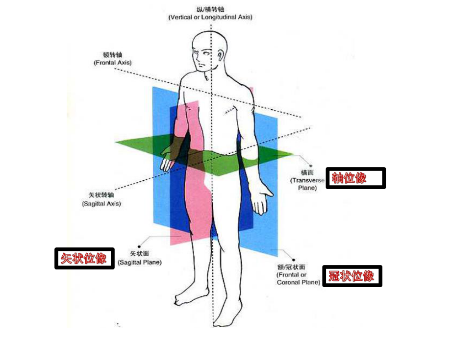 踝关节MR断层解剖课件.pptx_第3页