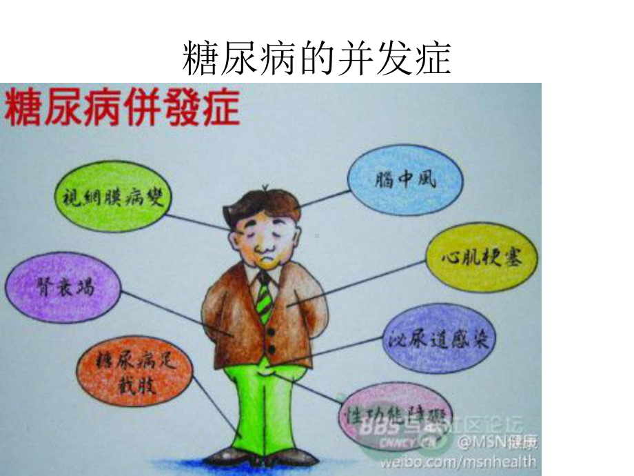 胰岛素泵在糖尿病中的应用课件.ppt_第3页