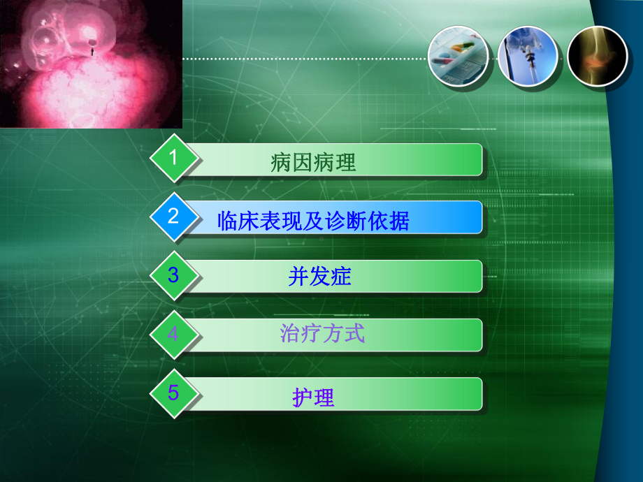 肺大泡的治疗及护理1.课件.ppt_第2页