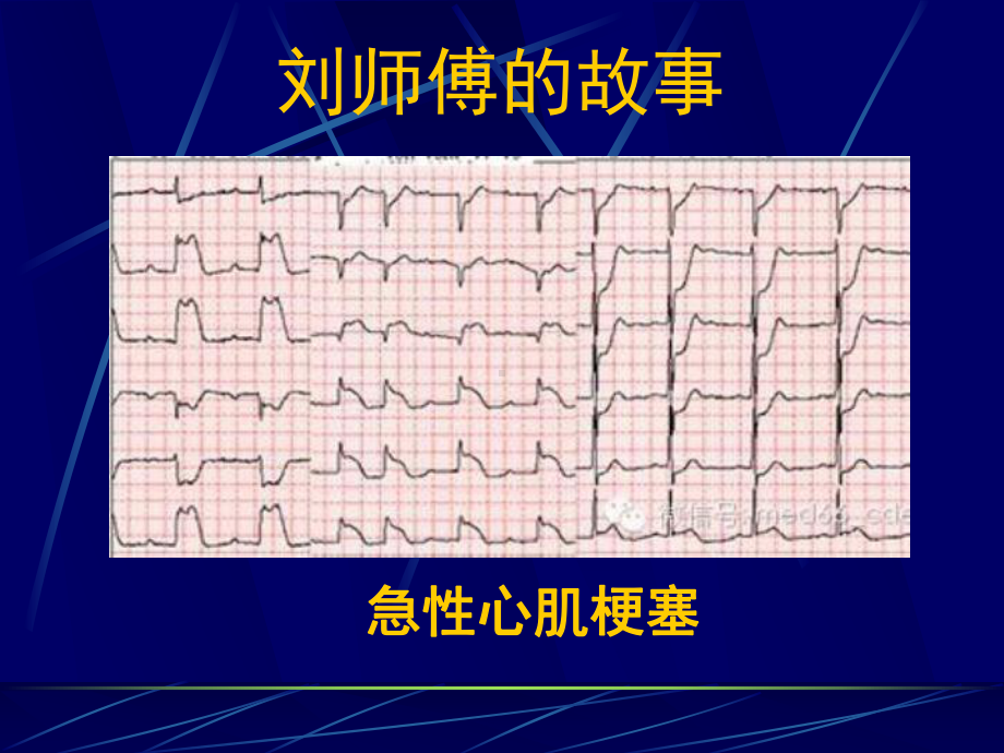 奇妙介入治疗(最终版)课件.ppt_第3页