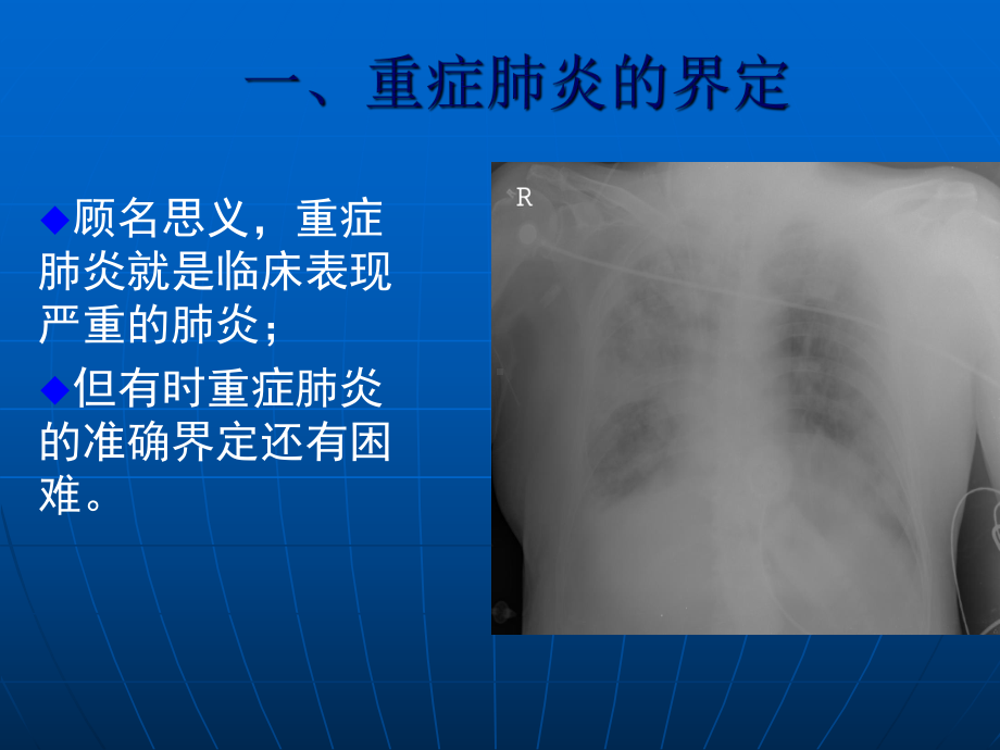 重症肺炎的诊治PPT课件.ppt_第2页