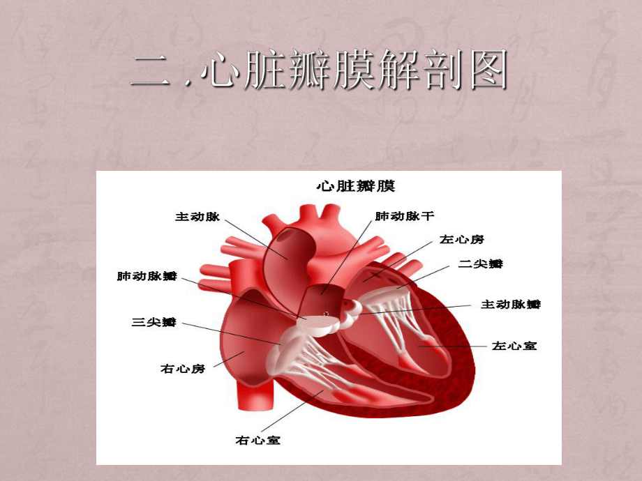 心脏瓣膜病围术期护理课件.ppt_第3页