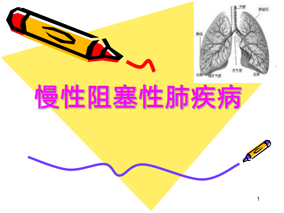 慢性阻塞性肺疾病学习PPT课件.ppt_第1页