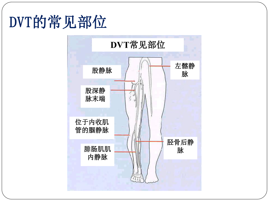 围手术期下肢深静脉血栓课件.ppt_第3页