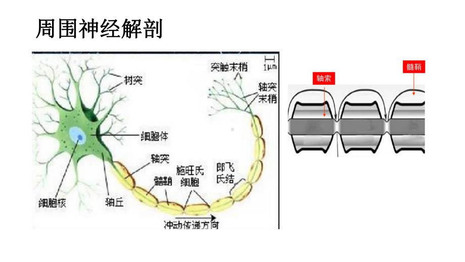 急性格林巴利综合征课件.pptx_第2页