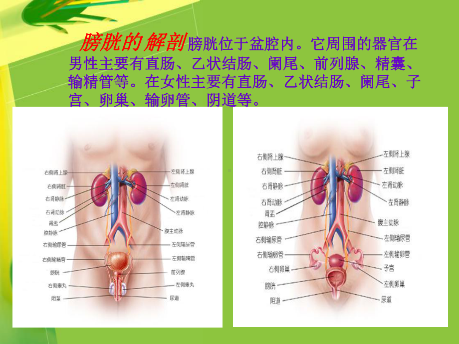 回肠代膀胱手术配合讲义课件.ppt_第2页