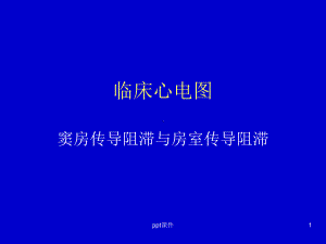 窦房传导阻滞与房室传导阻滞-ppt课件.ppt