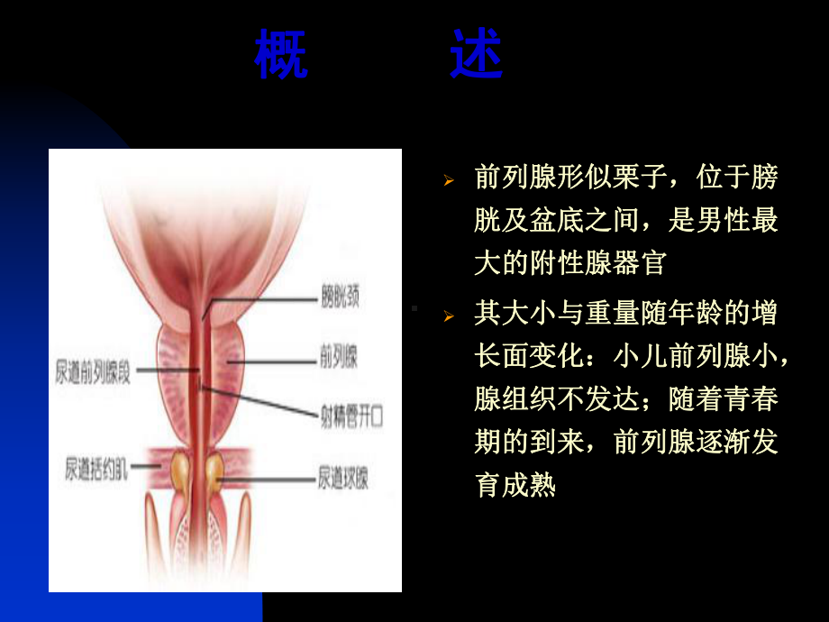 前列腺炎诊疗现状与进展课件.ppt_第3页