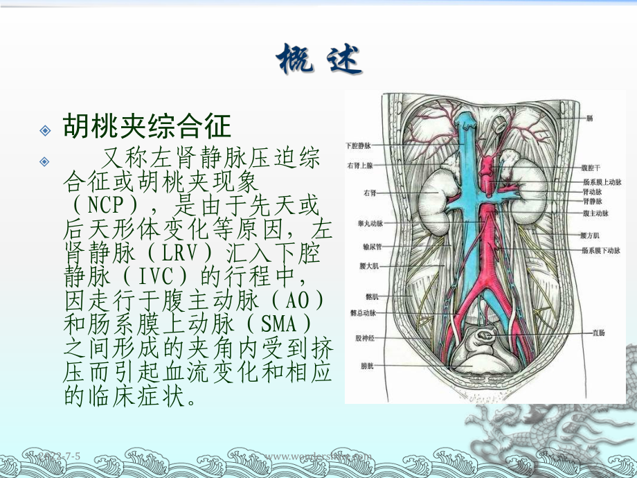 胡桃夹综合征45155课件.ppt_第3页