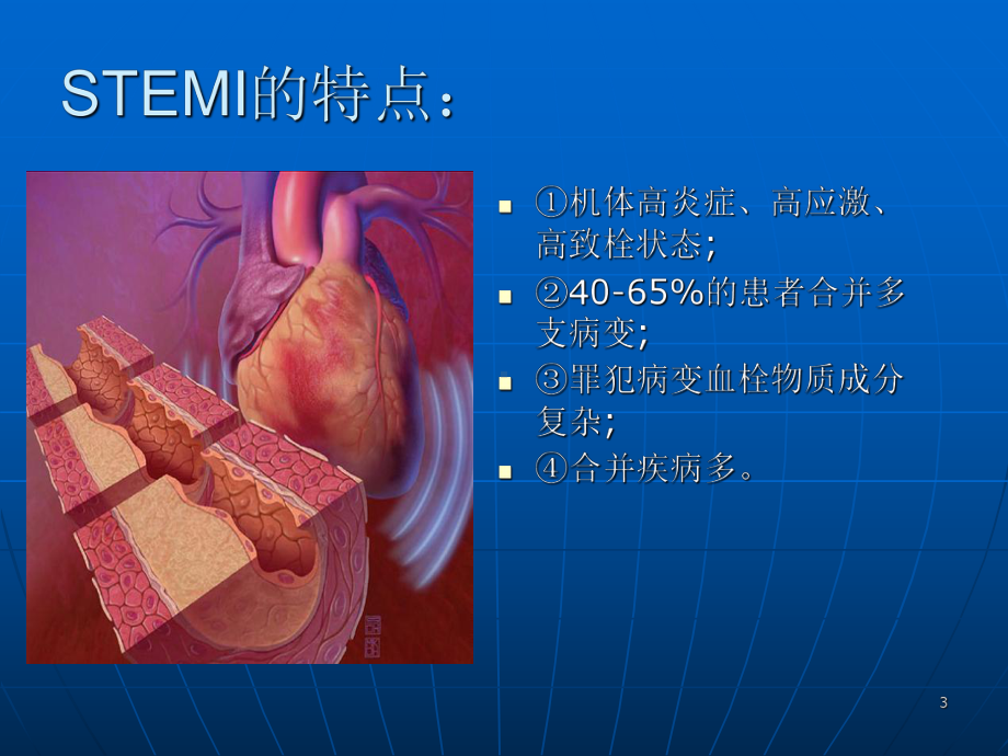 急诊PCI中同期还是分期处理非犯罪血管PPT课件.pptx_第3页