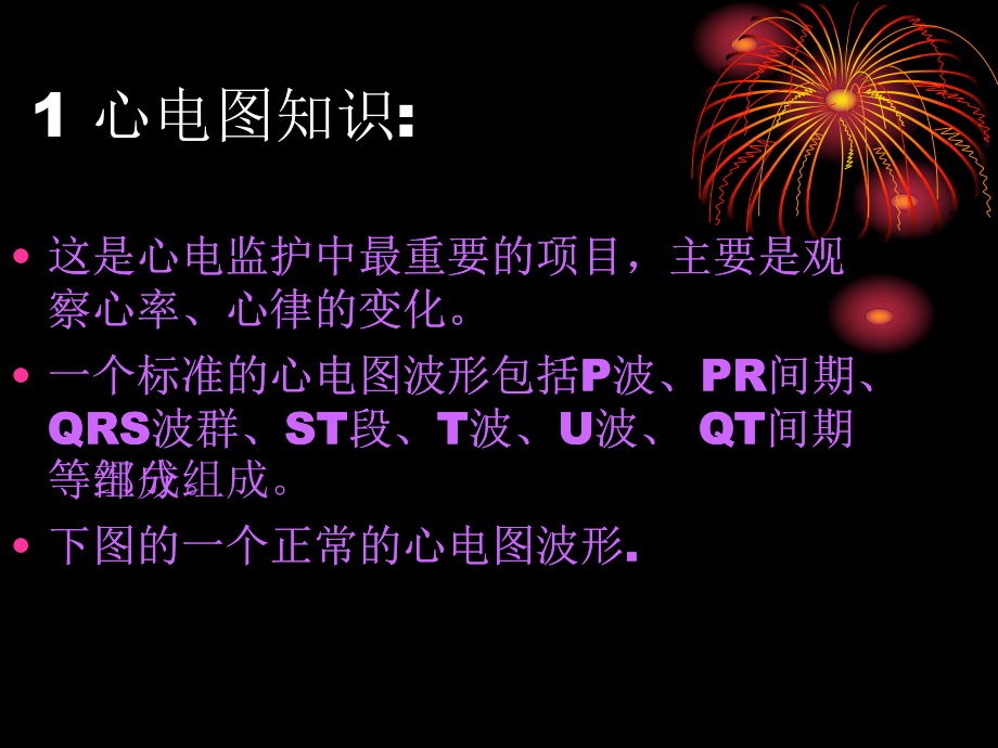 心电监护技术的临床应用课件.ppt_第3页