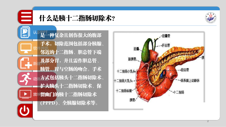 胰十二指肠切除术PPT课件.ppt_第2页