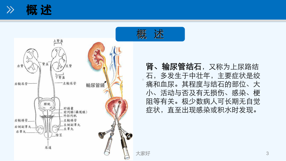 肾及输尿管结石病人的护理及健康教育-PPT1课件.ppt_第3页