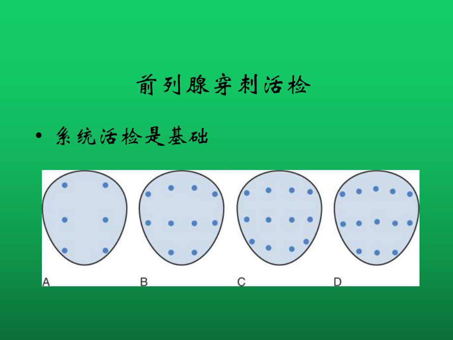 新的影像技术在超声引导下前列腺穿刺活检术中的运用课件.pptx_第3页