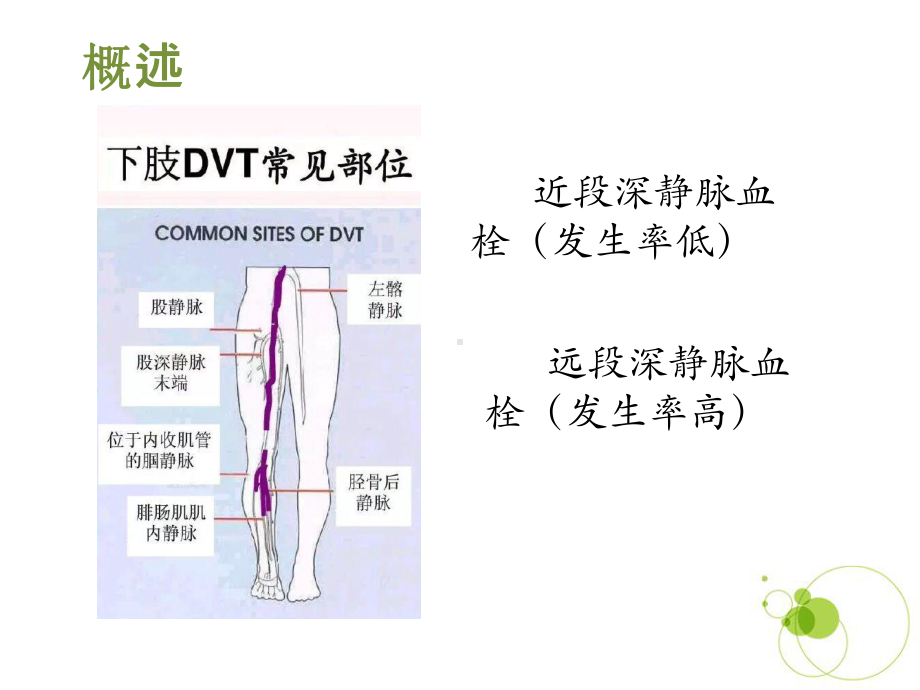 下肢静脉血栓预防ppt课件.pptx_第3页