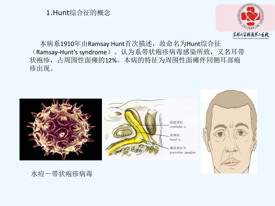 亨特综合征-PPT课件.ppt_第3页