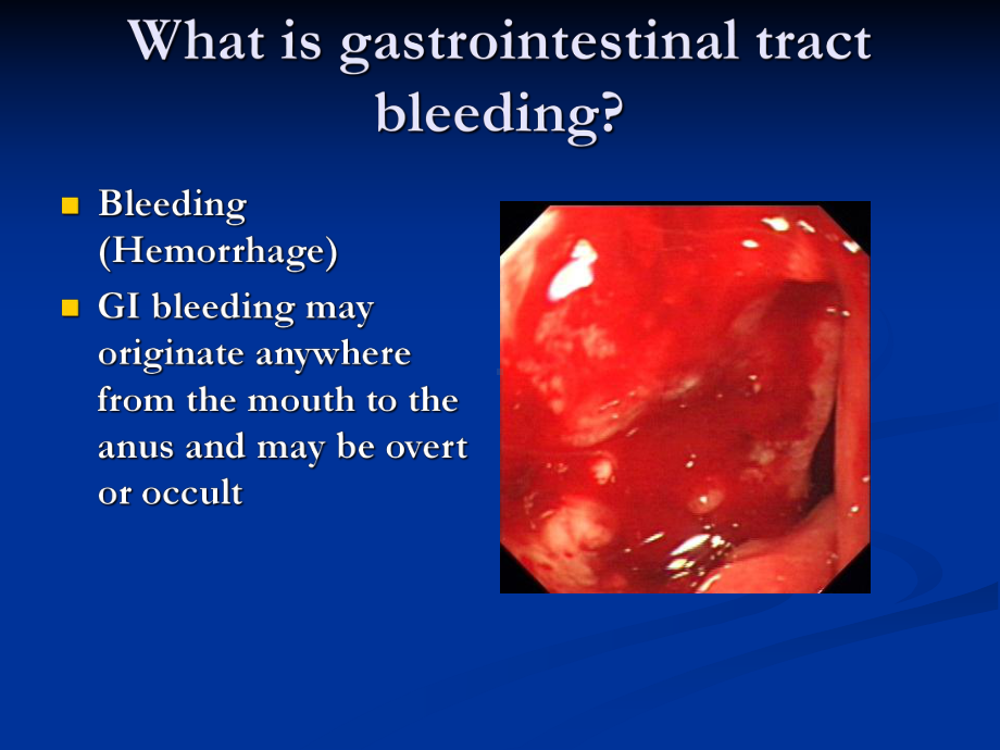 上消化道出血CBL教学课件.ppt_第3页