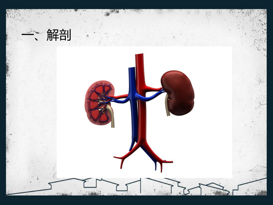 肾结石超声诊断及鉴别-PPT课件.pptx_第3页