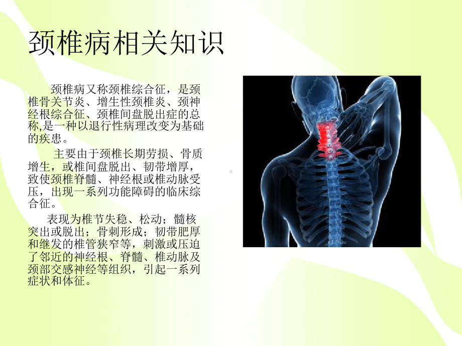 颈椎病健康教育朱桥桥课件.ppt_第2页