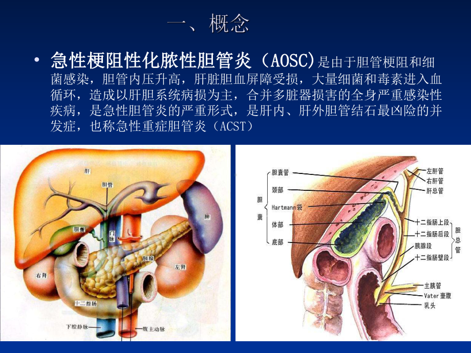 急性梗阻性化脓性胆管炎课件.ppt_第2页